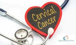 Does Stress Cause Cervical Cancer?