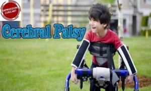 Cerebral Palsy