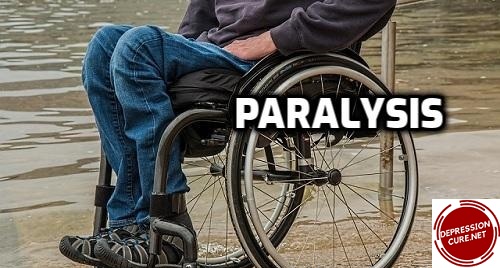 paralysis, What is paralysis, Symptoms of paralysis, Causes of Paralysis, Paralysis Prevention Measures, Diagnosis of Paralysis, Treatment of paralysis, Paralysis Risks & Complications, What to Eat During Paralysis, paralysis treatment