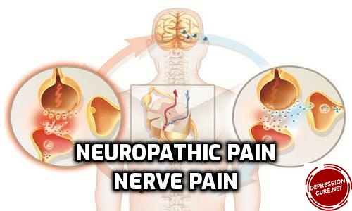 Neuropathic Pain | Nerve Pain