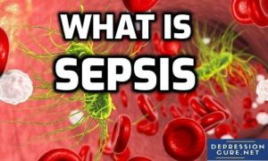 What is Sepsis?