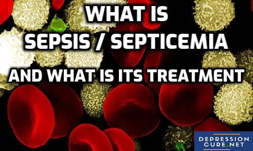 What is Sepsis Septicemia and What is its Treatment